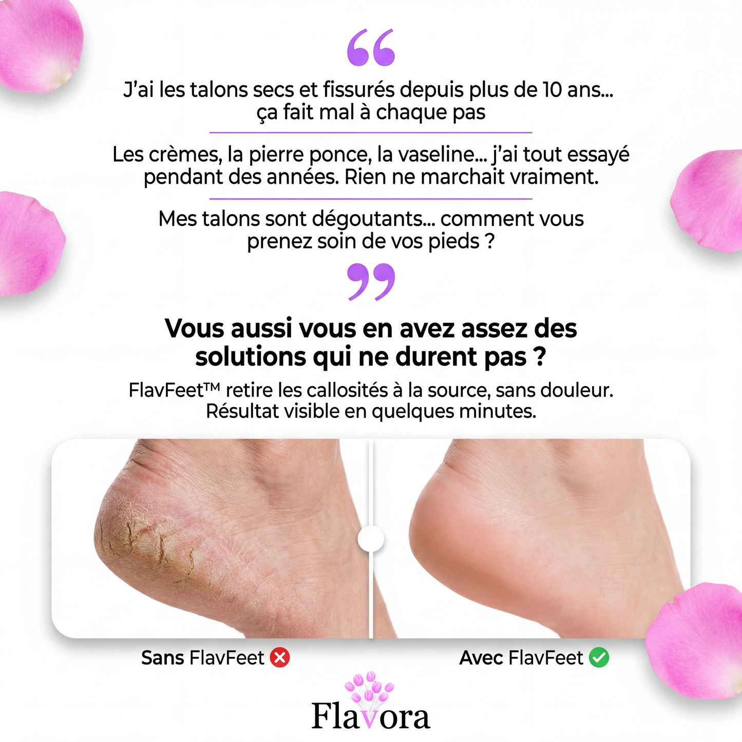 ✦ L'ORIGINAL I FlavFeet™