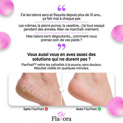 ✦ L'ORIGINAL I FlavFeet™